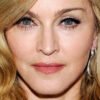 Overuse of Plastic Surgery Explaining Madonna's Face