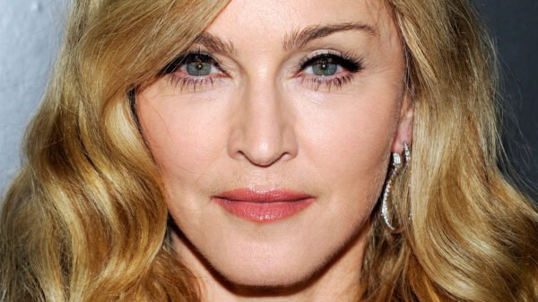 Overuse of Plastic Surgery Explaining Madonna's Face
